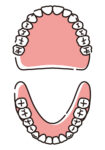 総義歯の咬合面のイラスト
