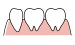 天然歯（小臼歯も含む）のイラスト